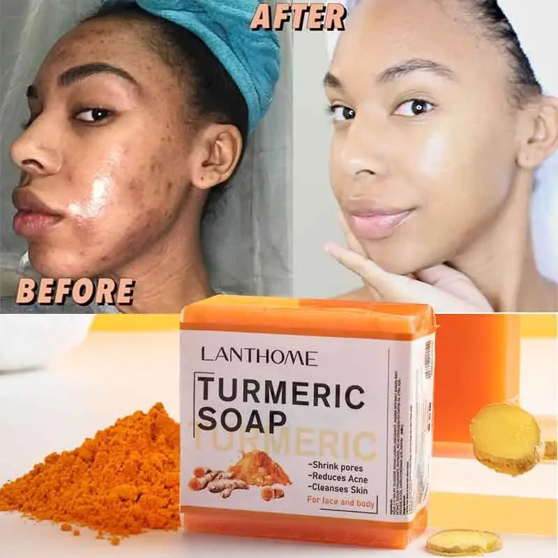 Face Cleansing Anti Acne